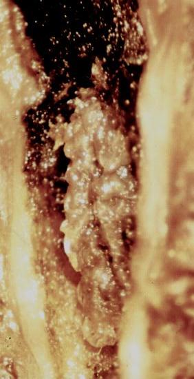 Epiblema strenuana